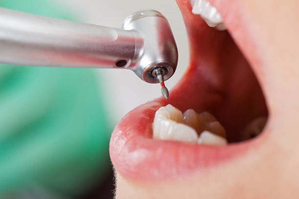 Best Tooth Infection Emergency Dentist  in Lansing, KS